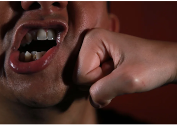 Hajar Petugas Kebersihan yang Tua Renta hingga Rahang dan Gigi Patah, Ulah Pria Ini Terekam Kamera CCTV