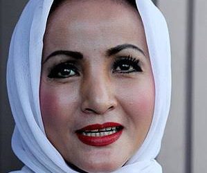 Jadi Korban Tabrak Lari, Machica Mochtar Tak Laporkan Pengemudi Angkot