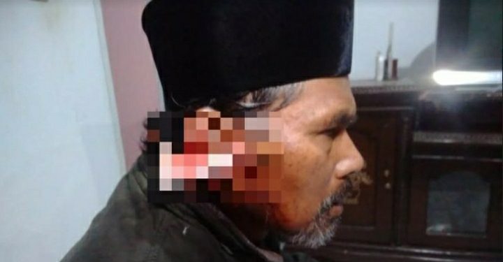 Mengerikan! Pria Misterius Tega Membacok Telinga Muadzin di Sukabumi Saat Sedang Salat Subuh