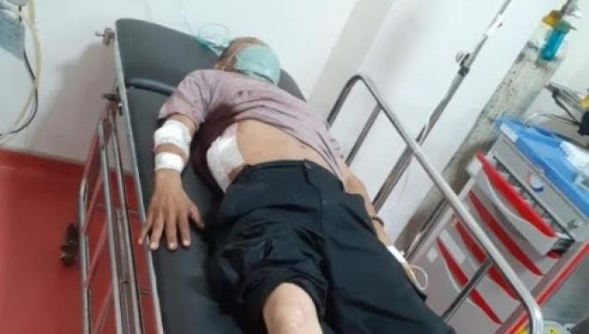 Kesal Gerobak Mau Dihancurin, Pedagang Kopi Keliling Tusuk Warga Pakai Pisau