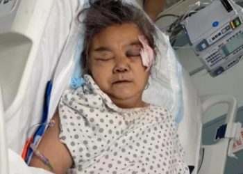 Kepalanya Dihantam hingga Koma, Nenek Ini Akhirnya Tutup Usia