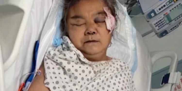 Kepalanya Dihantam hingga Koma, Nenek Ini Akhirnya Tutup Usia