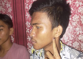 Kapolres Kampar Bantah Anggotanya Pukul Remaja Tunanetra