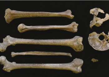 Tulang Belulang Manusia Ditemukan di Garasi Ohio, Berusia Lebih dari Seabad