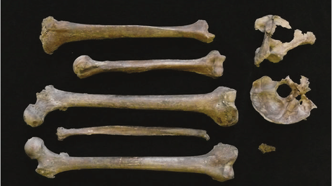 Tulang Belulang Manusia Ditemukan di Garasi Ohio, Berusia Lebih dari Seabad