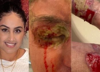 Mahasiswa Asal Pakistan Disirami Cairan Asam oleh Orang Asing, Sebabkan Kebutaan