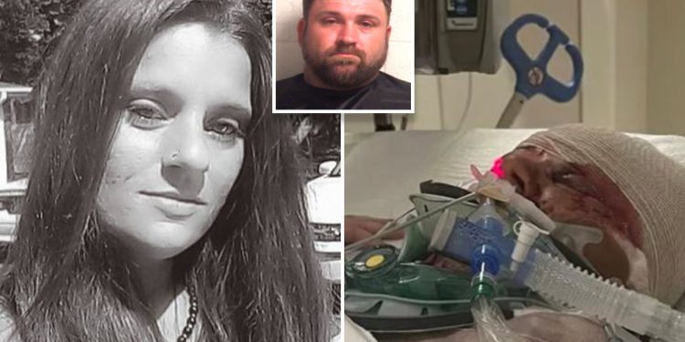 Wanita yang Lengannya Diamputasi karena Diserang Anjing Akhirnya Bangun dari Koma, Namun Harus Kembali Dibius lantaran Kaget Lihat Lengannya