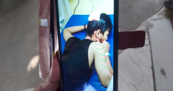 Pulang PKL Kunjungi Kerabat, Pelajar di Depok Dibacok Perampok Hingga Kritis