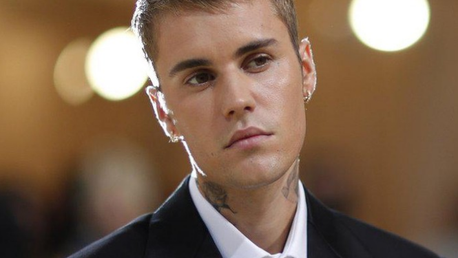 Justin Bieber Idap Sindrom Ramsay Hunt, Wajahnya Lumpuh Sebelah