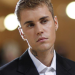 Justin Bieber Idap Sindrom Ramsay Hunt, Wajahnya Lumpuh Sebelah