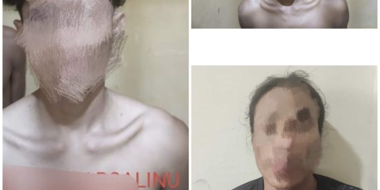 Camat Pulau Burung Inhil Dikeroyok Empat Pemuda, Tiga Pelaku Langsung Diringkus