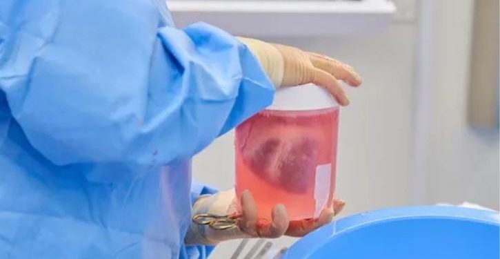Ilmuwan Berhasil Transplantasi Hati Babi yang Dimodifikasi Secara Genetik Menjadi Manusia Mati