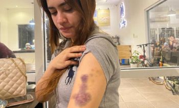 Kasus Penganiyaan Wanita Cantik, Polda Riau Tetapkan Polwan dan Ibunya Tersangka