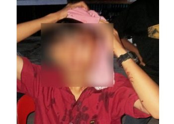 Diduga Dianiaya Geng Motor, Kepala Remaja di Pekanbaru Bocor