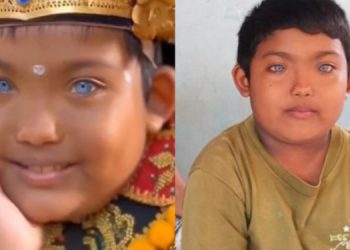 Fakta Anak Bali Bermata Biru, Ternyata Turunan dari Kakek Buyutnya