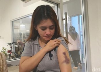 Korban Penyekapan dan Pemukulan Oknum Polisi Riau, Dilaporkan Kasus Pelanggaran ITE, Siapa Dia ?