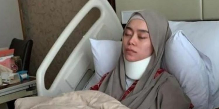 Dampak KDRT, Lesti Kejora Jalani Fisioterapi