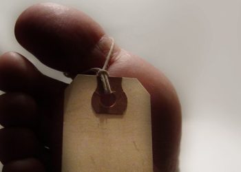 Kepala Berdarah, Wanita Tua Ditemukan di Sebuah Rumah Kalideres