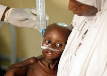 MSF: Krisis Malnutrisi Katastropik di Nigeria Barat Laut Harus Diakui