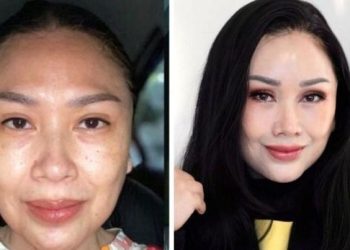 Mau Operasi Anti Aging seperti Titi DJ? Siapin Duit Segini