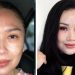 Mau Operasi Anti Aging seperti Titi DJ? Siapin Duit Segini