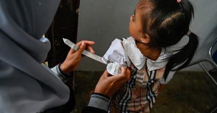 Bukan Cuma Badan Pendek, Ini 4 Gejala Stunting pada Anak