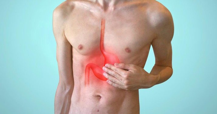 Profesor Harvard Beri 9 Tips Redakan Asam Lambung Tanpa Obat