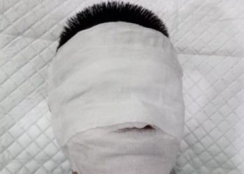 Polisi Tangkap 4 Remaja Pelaku Penyiraman Air Keras di Tangsel