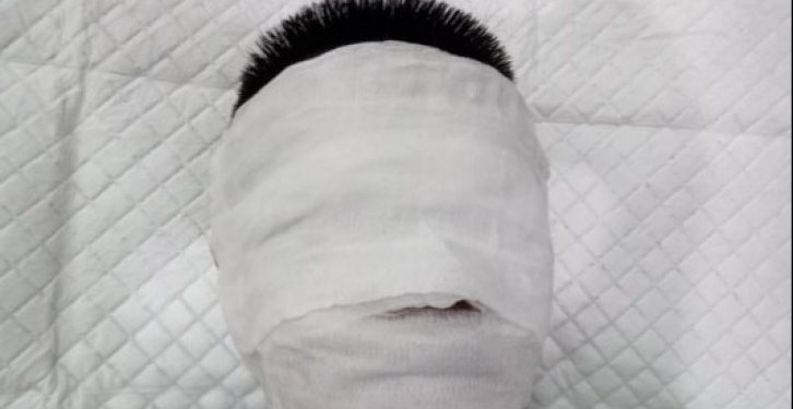 Polisi Tangkap 4 Remaja Pelaku Penyiraman Air Keras di Tangsel