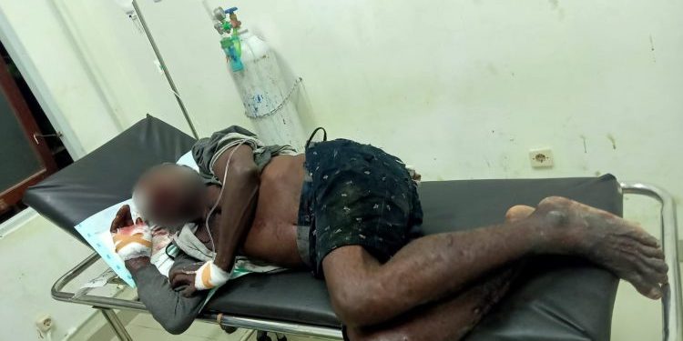 Kepergok Curi Cabai di Kebun, Pria di Jayapura Diamuk Massa