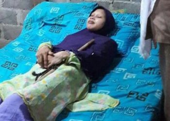 Sulami si ‘Manusia Kayu’ Tutup Usia, Pesan Terakhirnya Jadi Sorotan